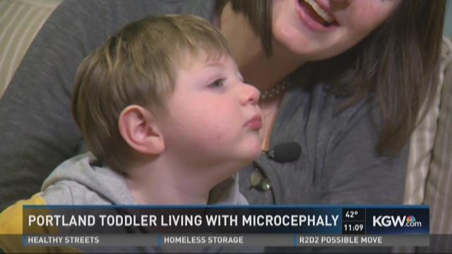 Beaverton toddler fights 'beyond rare' gene mutation